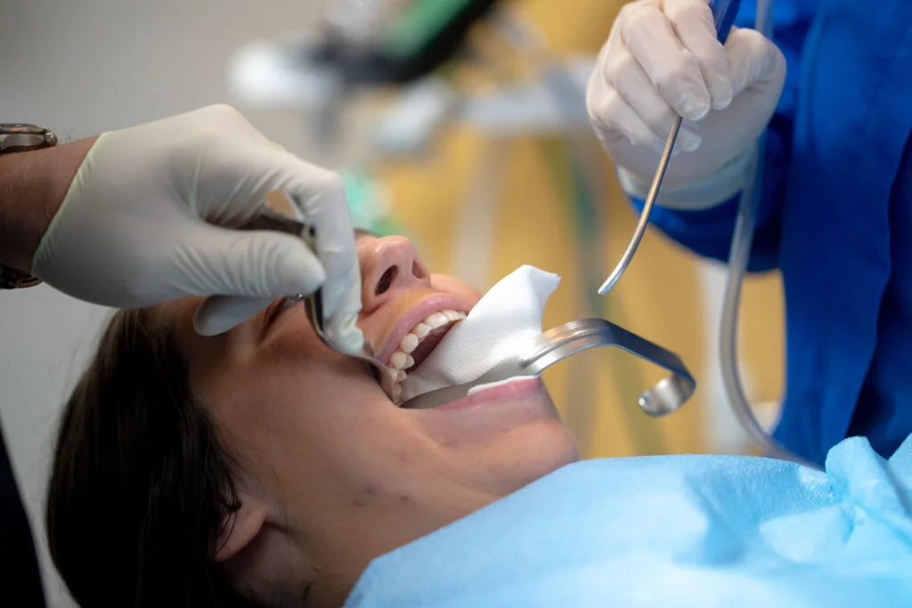 Wisdom Teeth Removal: Cost Factors, Recovery, Diet, Pain & Swelling 3 wisdom teeth removal recovery